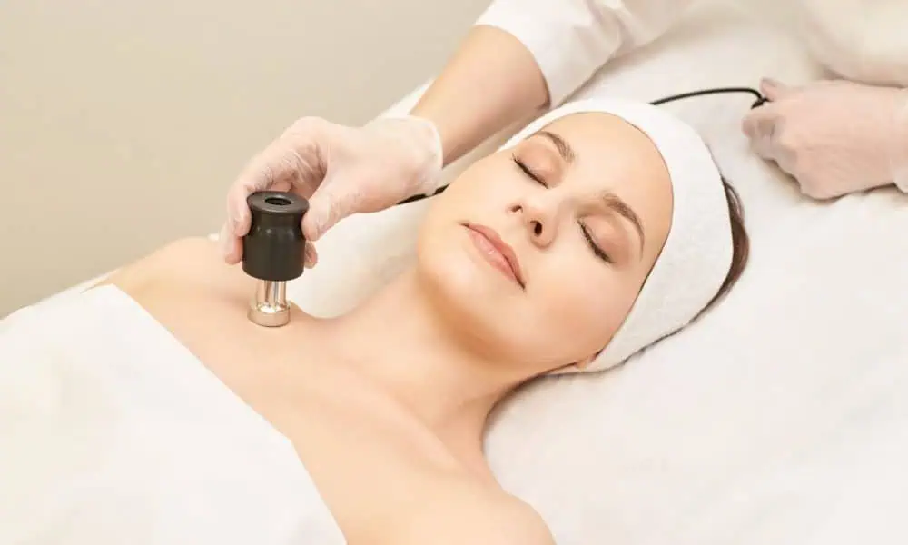 Microneedling with RF