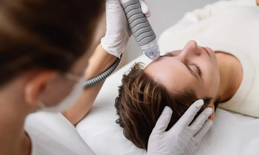 Microneedling with RF