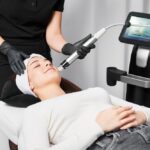 microneedling with rf in Maryville TN for skin tightening