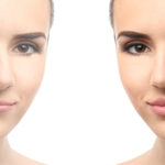 Natural Botox results in Maryville TN for refreshed look