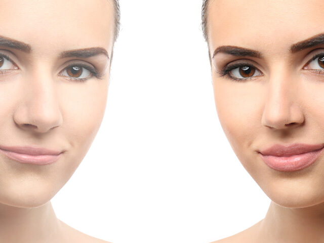 Look Refreshed, Not Frozen: Natural Botox Results in Maryville, TN