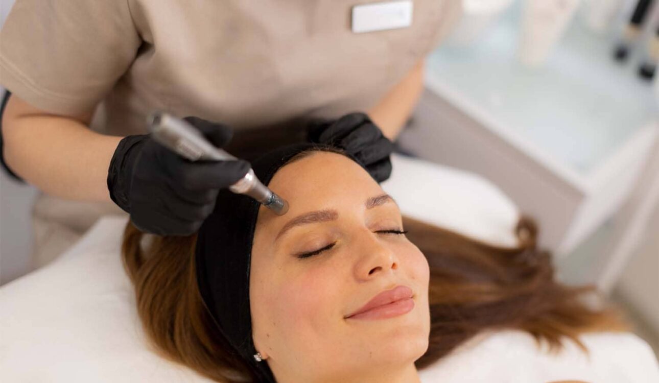 Patient receiving Microneedling with RF Maryville TN treatment at OptimalJoy Maryville clinic