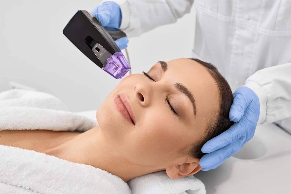 rf microneedling in Maryville TN in 2026 for stunning results and faster skin recovery