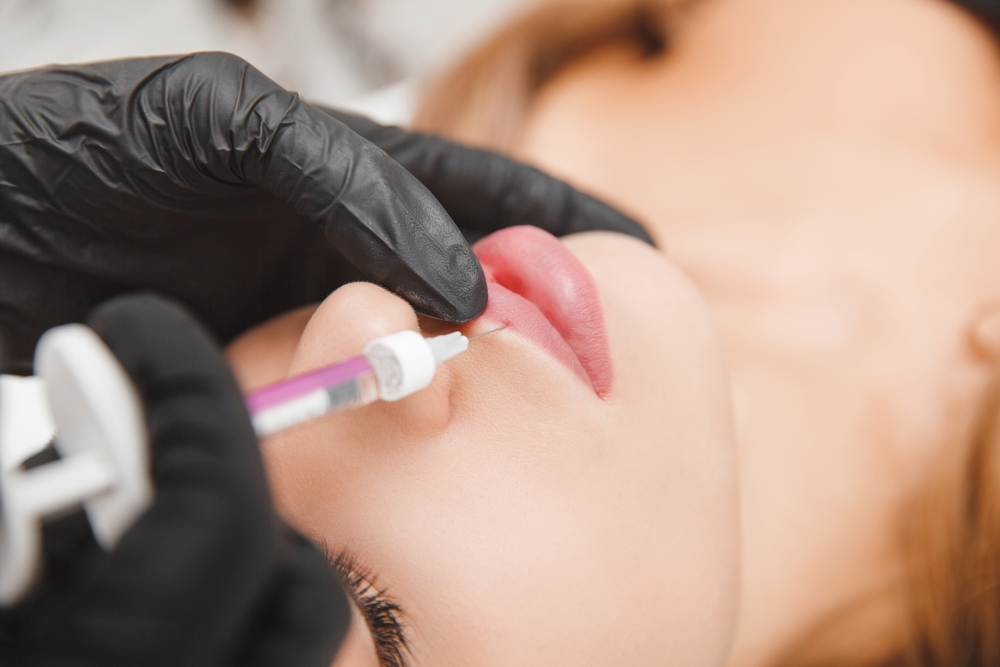 dermal filler treatment in Maryville TN for natural facial volume and lip enhancement
