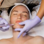 Microneedling with RF in Maryville TN for firmer youthful skin at OptimalJoy Wellness & Aesthetics