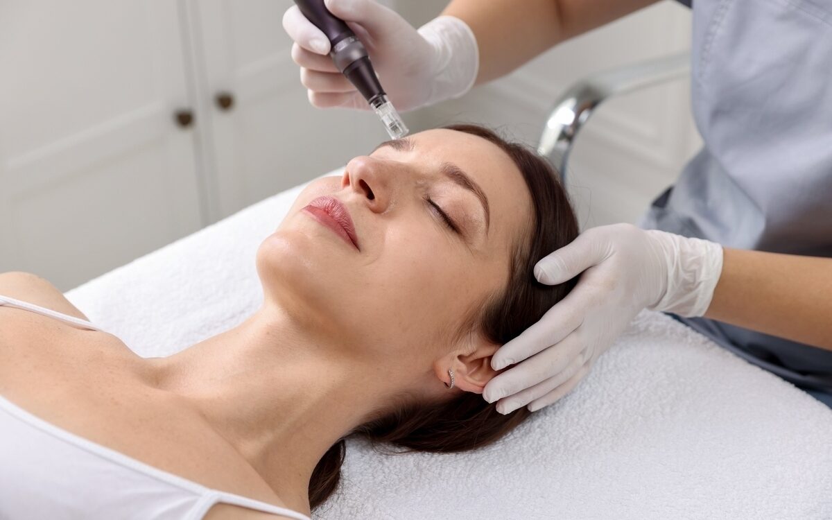 Gloved provider using microneedling device on patient face showing RF microneedling vs regular microneedling treatment
