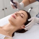 Gloved provider using microneedling device on patient face showing RF microneedling vs regular microneedling treatment