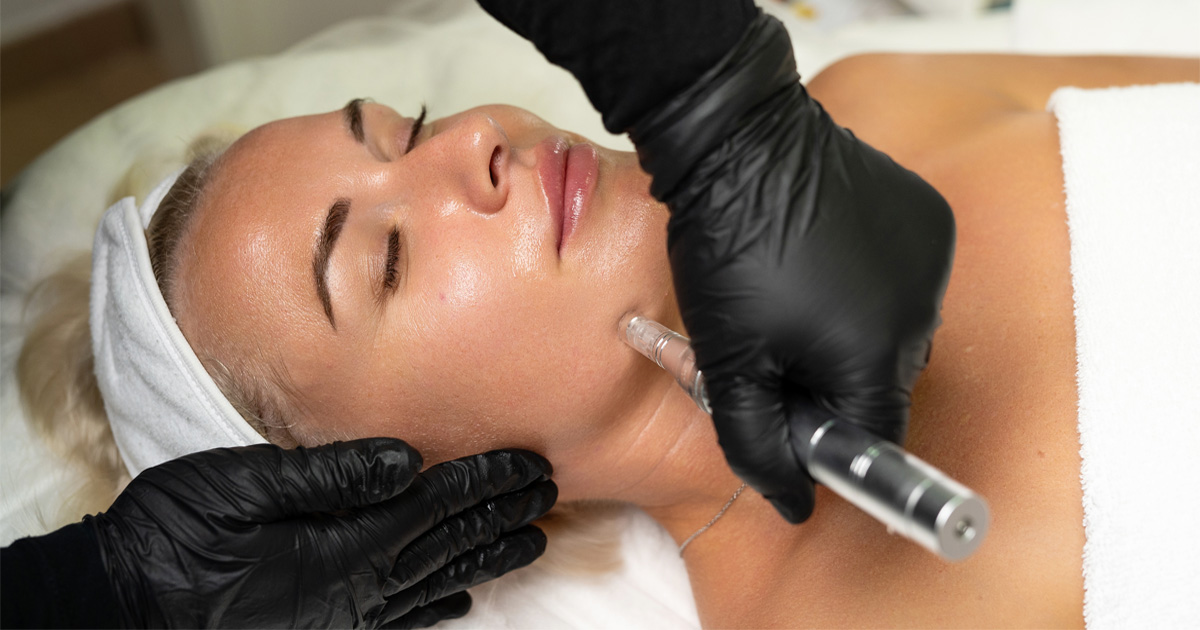 RF microneedling benefits for smoother skin texture and collagen production