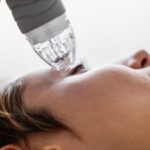 RF Microneedling Sessions for personalized skin treatment